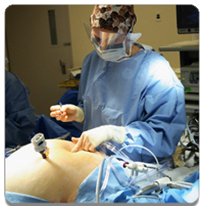 GENERAL LAPAROSCOPIC SURGERY